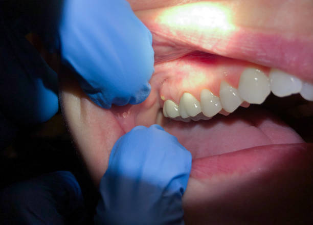 Best Emergency Denture Repair in Fearrington Village, NC