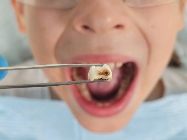 Best Urgent Care for Lost Fillings or Crowns in Fearrington Village, NC