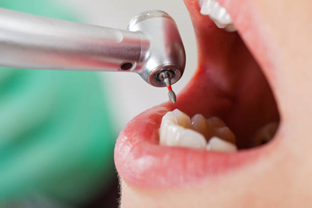Best Emergency Treatment for Dental Infections or Abscesses in Fearrington Village, NC